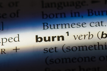 burn