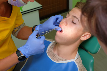 The doctor's hands attaching brackets on the teenager's teeth with a special pincers.