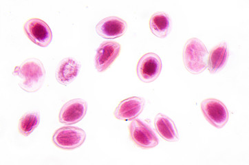 Microscope photography. Ascaris lumbricoides eggs.