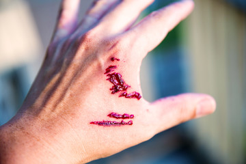 Focus dog bite wound and blood on hand. Infection and Rabies concept. Pet care and rabies prevention concept. Accidental and first aid concept. image for background, objects, copy space.