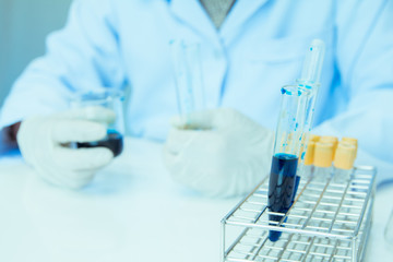 Fototapeta premium Close up. Medical or male medical ,holding tube beaker in laboratory room research performs tests with blue liquid, Experimental Drug Treatment