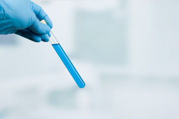 Hand eines Wissenschaftlers hält Reagenzgläser mit blauer Flüssigkeit vor Labor im Hintergrund