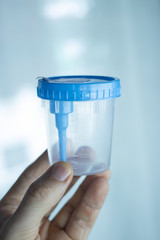 Urine sample test cup