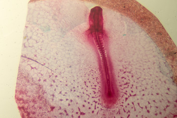Development of the embryo chicken,The development of the chick on the slide under microscope.