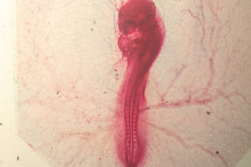 Development of the embryo chicken,The development of the chick on the slide under microscope.