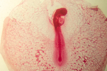 Development of the embryo chicken,The development of the chick on the slide under microscope.