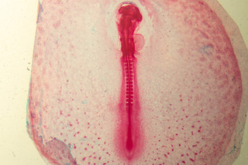 Development of the embryo chicken,The development of the chick on the slide under microscope.
