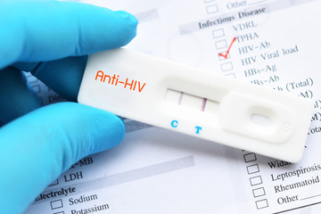 HIV positive test result by using rapid test cassette