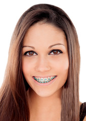 Beautiful portrait of a young girl with brackets