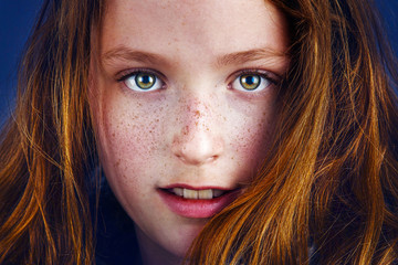 girl with freckles