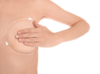 Young woman with marks on breast for cosmetic surgery operation against white background