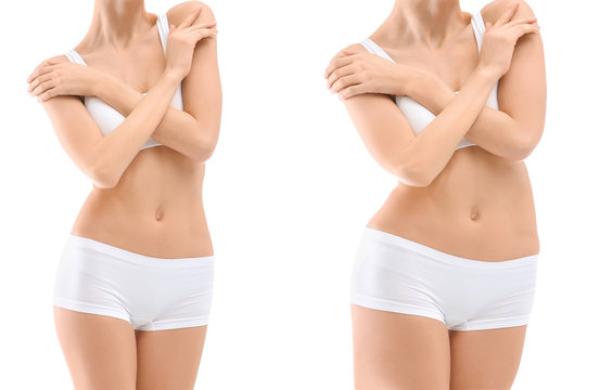 Young woman before and after liposuction operation on white background, front view. Cosmetic surgery