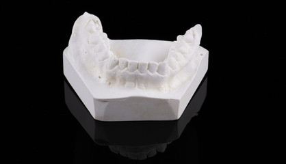 Wax pattern teeth dental crowns on model, metal free - front view .Ceramic front veneers isolated on black background. Metal-Ceramic crowns on gypsum model in dental laboratory.