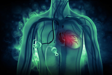 Dialysis process 3d illustration