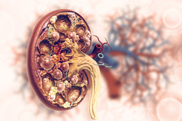 Kidney disease