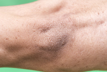 Fototapeta premium hand, elbow male macro