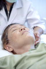 Obraz na płótnie Canvas asian woman undergoing of acupuncture beauty face treatment
