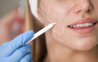 Beautiful young woman with squares grid on her face. Beautiful woman getting lifting injection in...