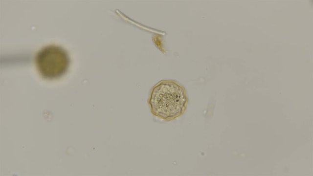 testate amoeba Arcella gibbosa under the microscope