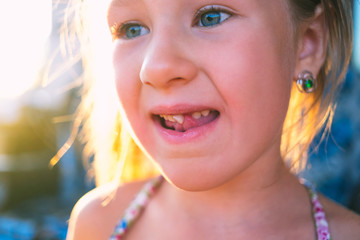 Obraz premium Portrait of a little girl with an outstretched milk tooth