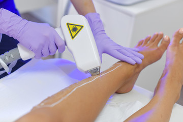 Epilation with a diode laser, hair removal with laser