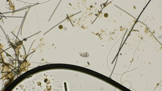 the motion of the rotifer of the genus Keratella, under a microscope