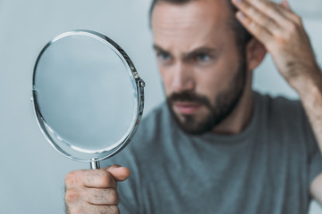close-up view of bearded mid adult man with alopecia looking at mirror, hair loss concept - obrazy, fototapety, plakaty