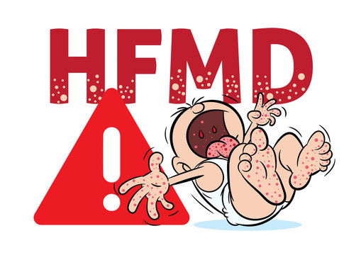 Crying baby with hand, foot and mouth disease or HFMD illustration