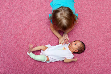 Bird Eye View of Older Sister Comforting Newborn Baby Wearing a Cast to Correct Her Clubfoot
