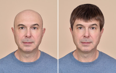 Two portraits of a same middle aged bald man before and after wearing wig