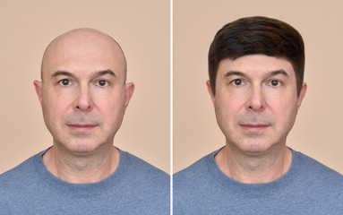 Two portraits of a same middle aged bald man before and after wearing wig