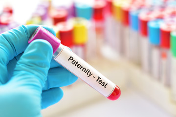 Fototapeta premium Test tube with blood sample for paternity test 