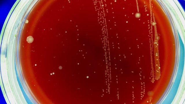 growth of bacteria taken in a bathroom in a Petri dish time lapse