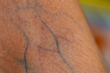 A physical of tissue, nerves, tendons at hand.