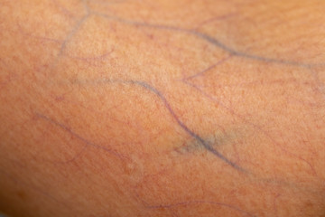 A physical of tissue, nerves, tendons at hand.