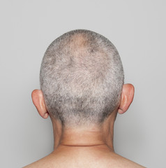 Bald head of man view from back