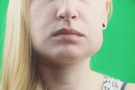 Teeth Problem. Gumboil, flux and swelling of the cheek. Closeup Of Beautiful Sad Girl Suffering From Strong Tooth Pain. Attractive Female Feeling Painful Toothache, Dental Health And Care Concept