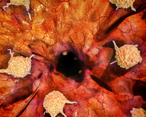 Cancer cells, 3d illustration