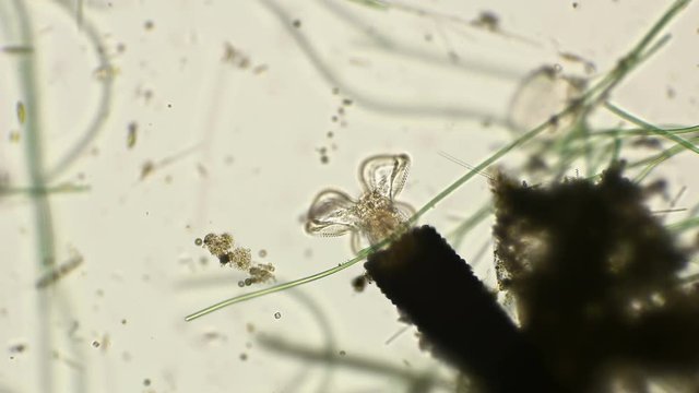 rotifer Floscularia ringens filters water by rotating its cilia, under a microscope filters water by rotating its cilia, under a microscope