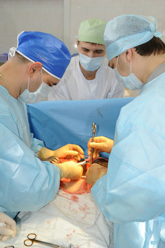 Surgeons do the operation.