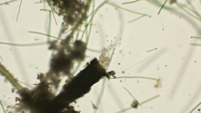 rotifer Floscularia ringens filters water by rotating its cilia, under a microscope filters water by rotating its cilia, under a microscope