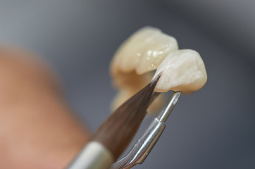 Closeup of dental technician putting ceramic to dental implants in his laboratory.