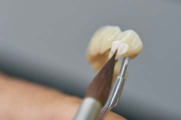 Closeup of dental technician putting ceramic to dental implants in his laboratory.