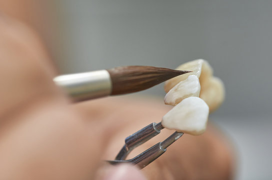 Closeup of dental technician putting ceramic to dental implants in his laboratory.