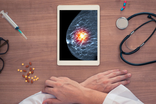 Breast cancer prevention. Top view on a medical desk with hands of the doctor. Mammograph on the digital tablet