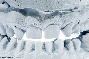 tooth impression © Andy Nowack