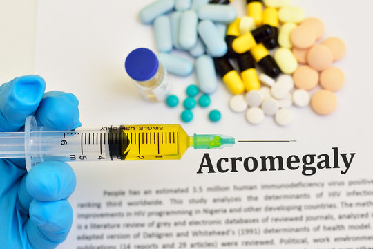 Drugs for Acromegaly treatment, abnormal growth hormone disease
