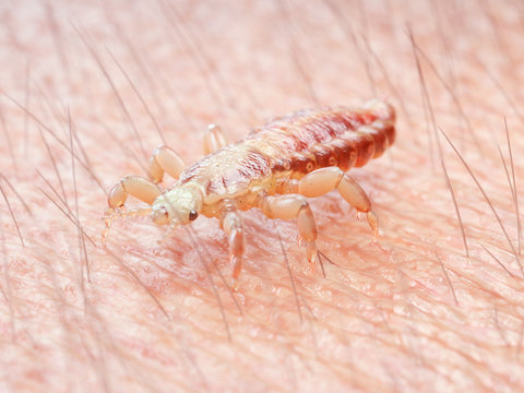 3d rendered illustration of a head louse on human skin