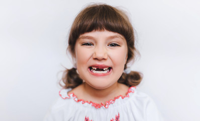 A little girl shows her milk teeth. Temporary baby teeth fall out. Toothless first grader.