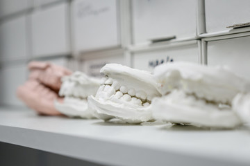 Fototapeta na wymiar Dental casting gypsum model plaster cast stomatologic human jaws prothetic laboratory, technical shots